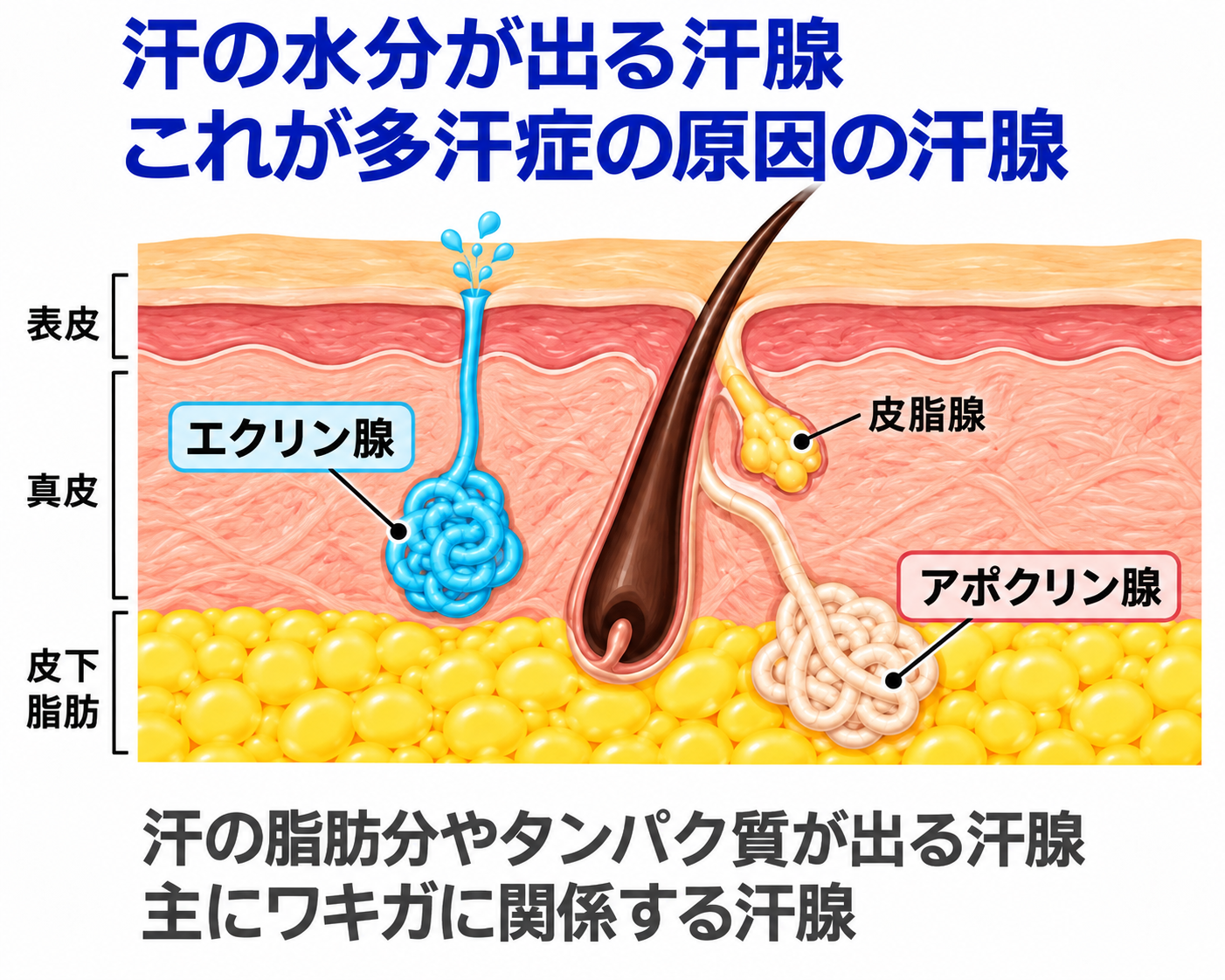 わきが