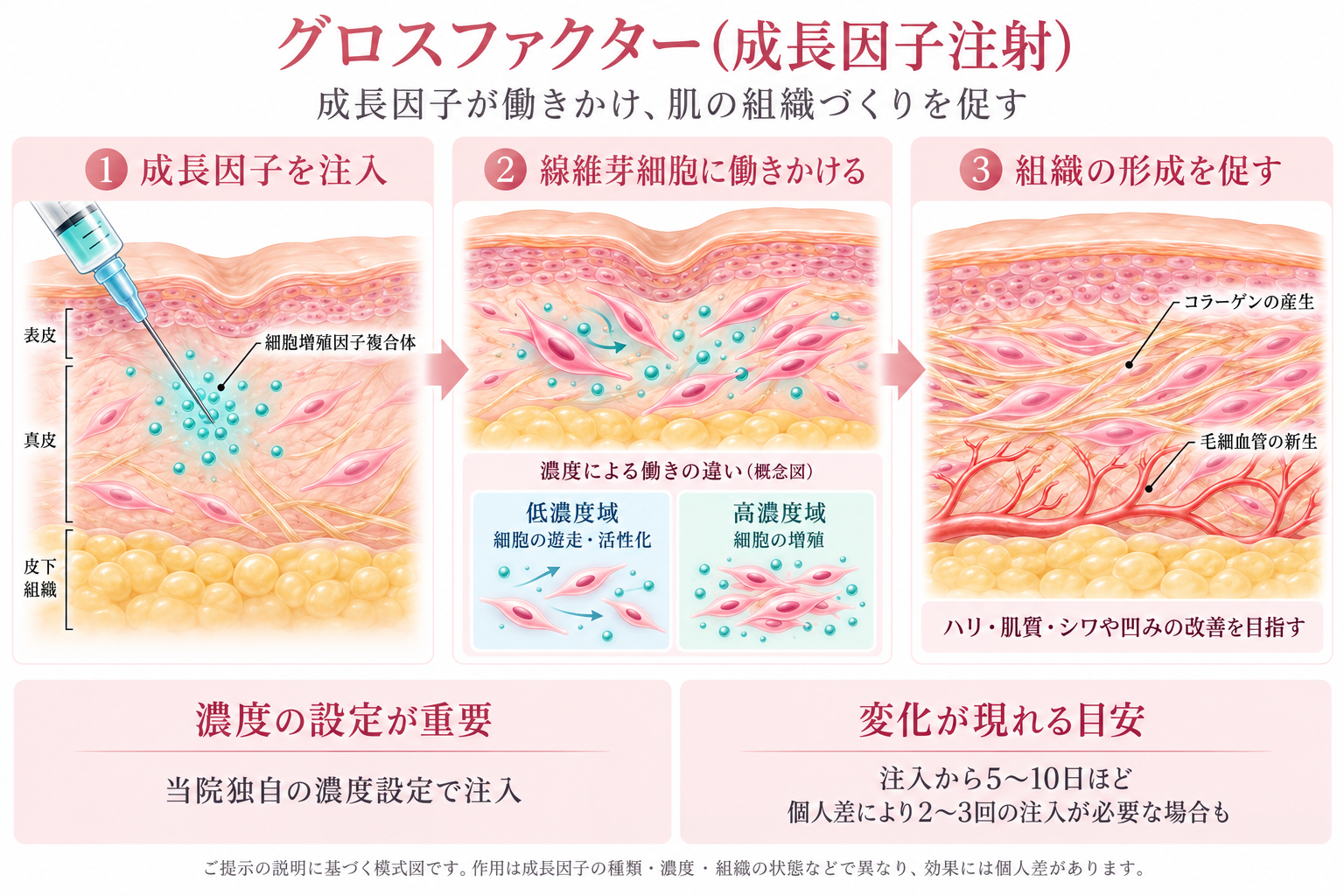 グロスファクター