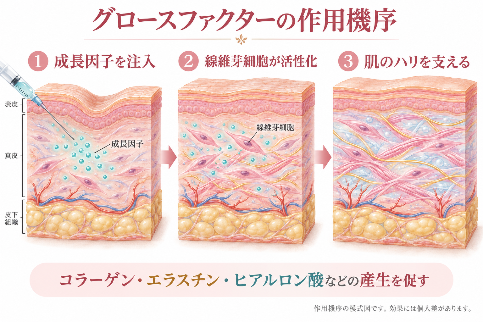グロースファクター
